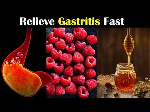 7 Effective Ways To Relieve Gastritis Fast At Home |Natural Remedies For Gastritis