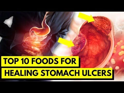 Top 10 Foods to Heal Your Stomach Ulcer Naturally | Natural Remedies for Peptic Ulcers