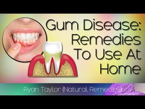 Natural Remedies: for Gum Disease (Home Treatment)