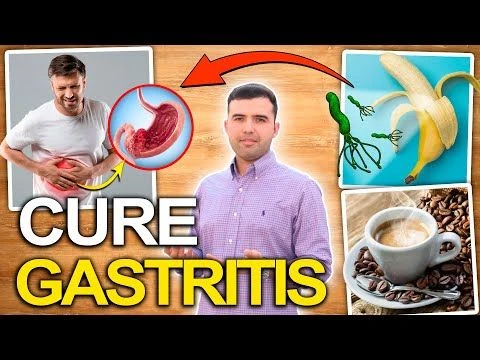 CURE GASTRITIS NATURALLY - 5 Natural Ways To Eliminate Gastritis