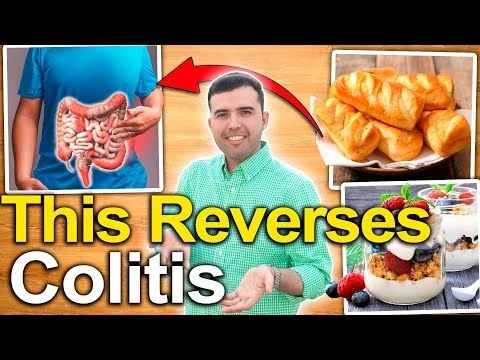 How to Treat Ulcerative Colitis? - Foods and Natural Remedies to Cure Ulcers in the Colon