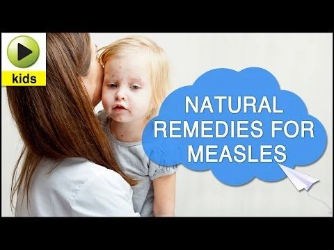 Kids Health: Measles - Natural Home Remedies for Measles