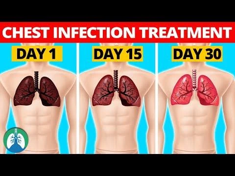 7 Natural Chest Infection Treatments (Home Remedies)