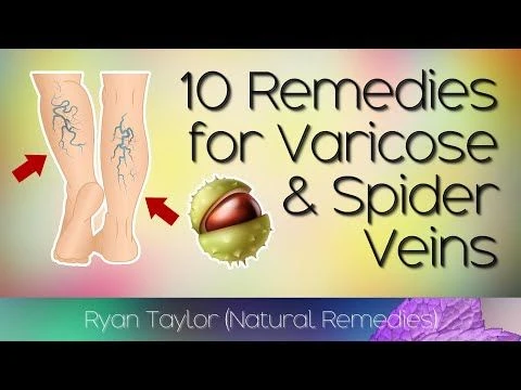 10 Natural Treatments for Varicose Veins  Spider Veins