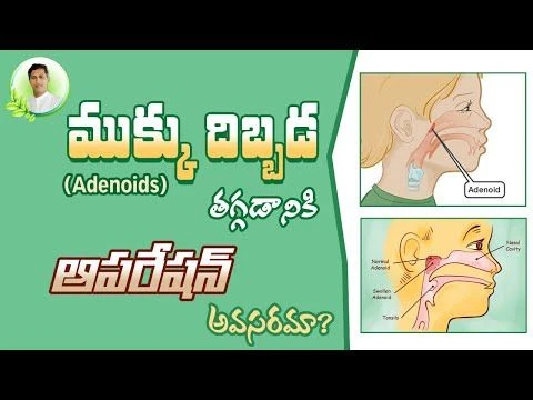 Natural Remedy for Adenoids in Nose | Health Tips In Telugu | Manthena Satyanarayana Raju Videos