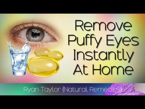 How To Remove Puffy Eyes Instantly (Natural Remedies)