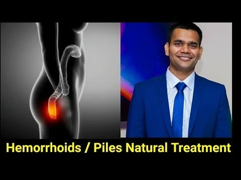 Piles Natural Treatment | How To Shrink Hemorrhoids Fast And Naturally / Dr. Vivek