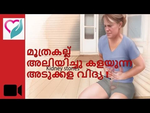 Kidney Stone Natural Treatment to dissolve stone | Malayalam | മൂത്രകല്ല് | Ethnic Health Court