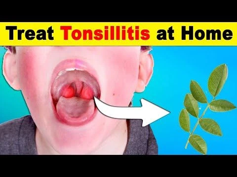 How to Treat Tonsillitis at Home | Effective Natural Remedies for Fast Relief