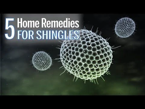 5 Home Remedies for Shingles | Health