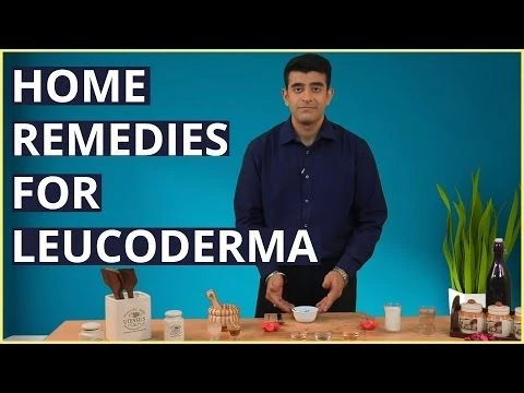 3 Best LEUCODERMA (VITILIGO) Treatments At Home With Natural Remedies