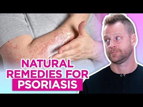 How to Get Rid of Psoriasis – Natural Remedies for Psoriasis